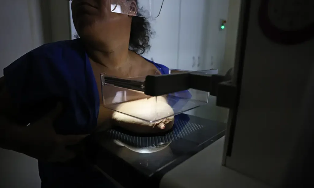 Vigitel: 92% das brasileiras entre 50 e 69 anos fizeram mamografia